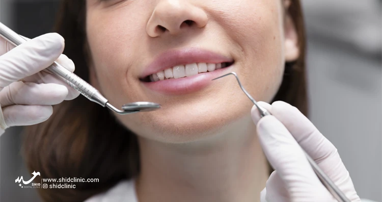 کلینیک دندان پزشکی شید دندان مصنوعی ریتنشن پروتز دندان