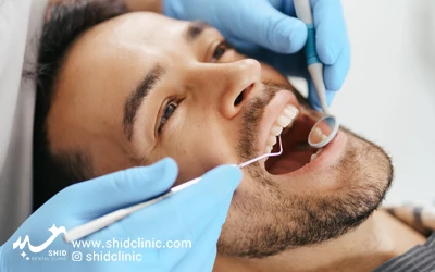 جرم گیری دندان پولیش دندن مصنوعی کلینیک دندانپزشکی شید زیبایی دندان