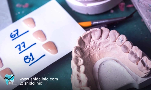 دندان های مصنوعی چگونه ساخته می شوند؟