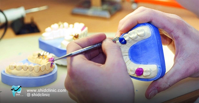 دندان های مصنوعی چگونه ساخته می شوند؟