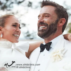 افراد مشهور با دندان مصنوعی کلینیک شید دندانپزشکی Ben Affleck بن افلک