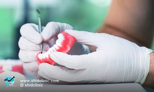 تفاوت بین تکنسین دندانپزشکی و دندان مصنوعی شید کلینیک دندانپزشکی شید