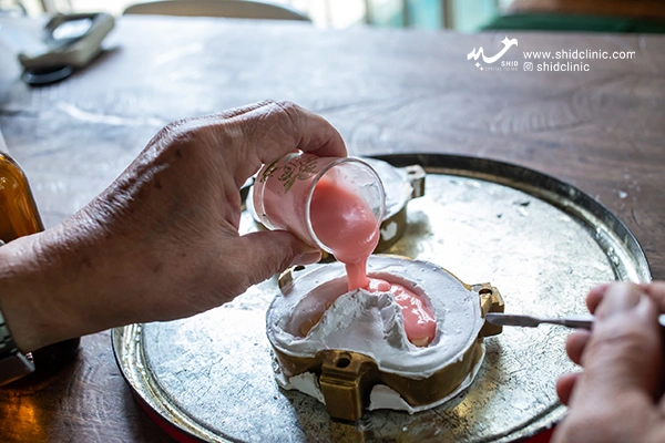 فرآیند9مرحله ای در دندان مصنوعی کلینیک شید دندانپزشکی