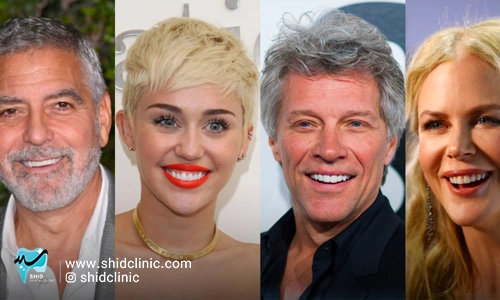 افراد مشهور با دندان مصنوعی کلینیک شید دندانپزشکی