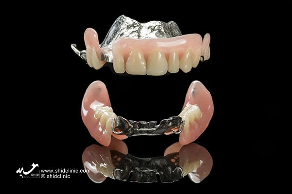 لابراتوار دندانسازی در تهران کلینیک دندانسازی شید