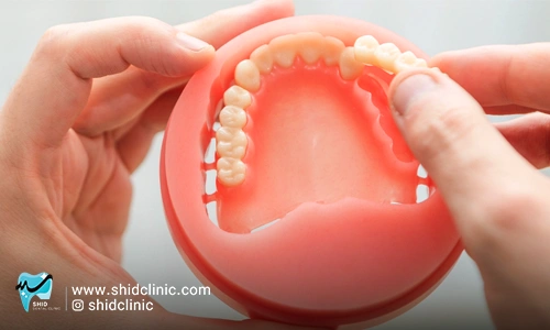 دندانسازی شید - بهترین برند دندان‌ مصنوعی shid clinic