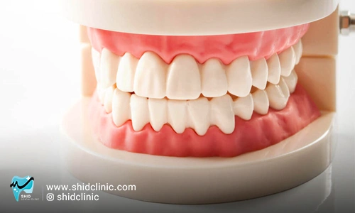 لابراتوار دندانسازی در تهران کلینیک دندانسازی شید