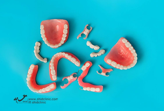 دندانسازی شید - بهترین برند دندان‌ مصنوعی shid clinic