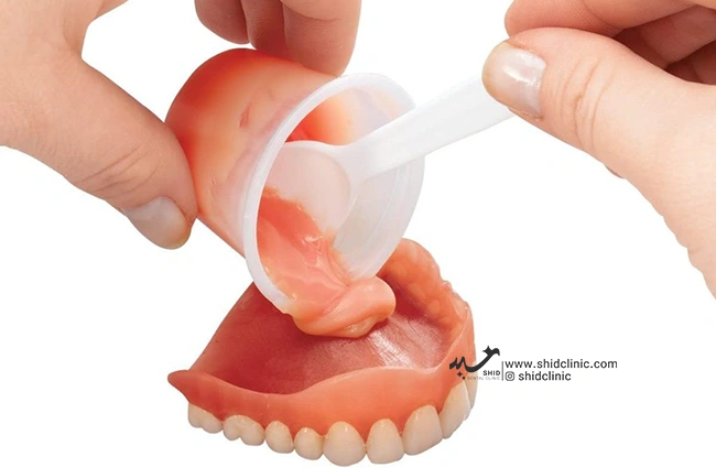دندانسازی شید - بهترین برند دندان‌ مصنوعی shid clinic