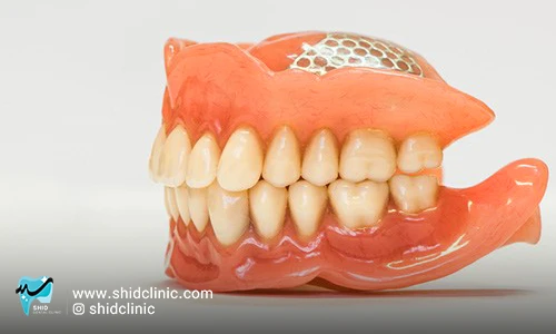 دندان مصنوعی برای لثه‌های صاف و تحلیل رفته در بهترین لابراتوار دندانسازی تهران - شید کلینیک