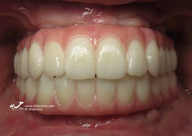 آلرژی‌ها و حساسیت‌ها