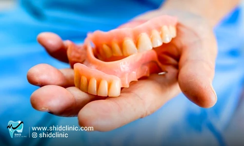 معایب و مشکلات دندان مصنوعی از صفر تا صد shid clinic