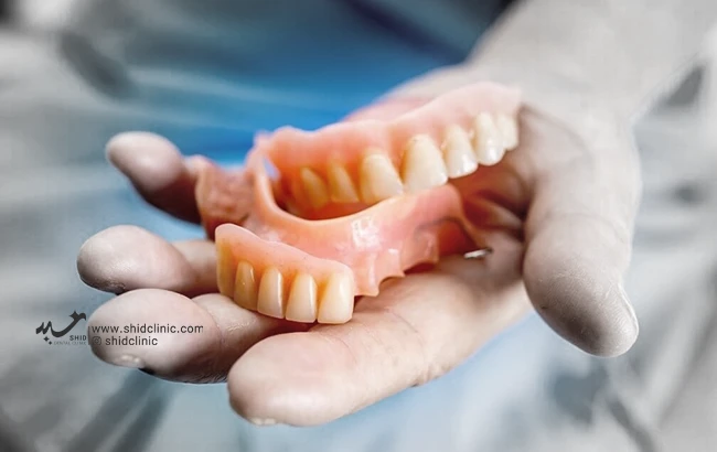 معایب و مشکلات دندان مصنوعی از صفر تا صد