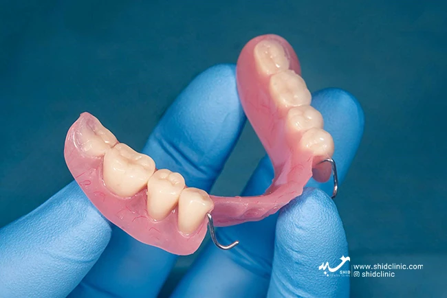 دندان مصنوعی بدون سقف