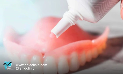 چسب دندان مصنوعی فیکسودنت لیست قیمت ومعرفی محصولات