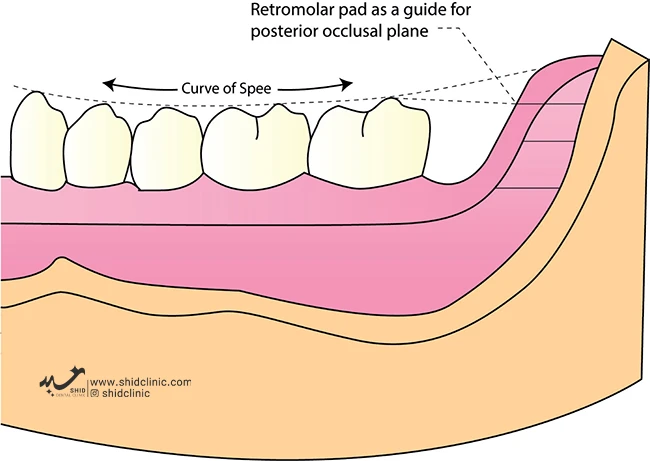 مشکل صحبت با دندان مصنوعی+راهکار حل مشکل