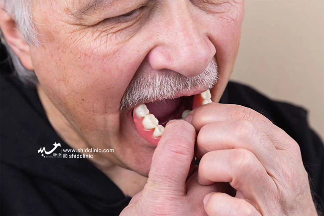 دندان مصنوعی