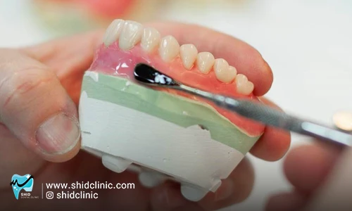 بهترین برند دندان مصنوعی - بهترین لابراتوار دندانسازی - قیمت کامل دندان مصنوعی – انتخاب دندان مصنوعی – لثه نرم – لقی دندان مصنوعی – آسان ترین دندان مصنوعی – کم خرج ترین روش دندان گذاشتن