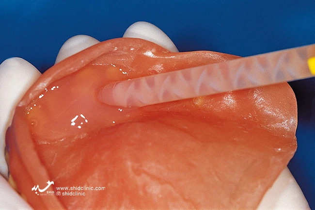 ۳. بهترین برندهای دندان مصنوعی خارجی