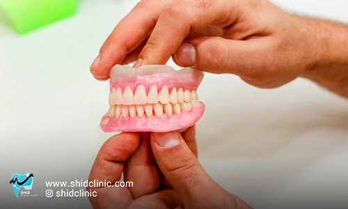 جزئیات لقی دندان مصنوعی: علل لقی، نگهداری و راهکار