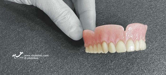 دندان مصنوعی فوری