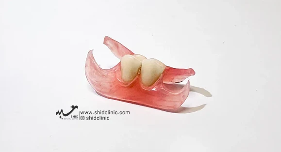 پروتزهای تکه‌ای شفاف: راهی نوین در دندانپزشکی
