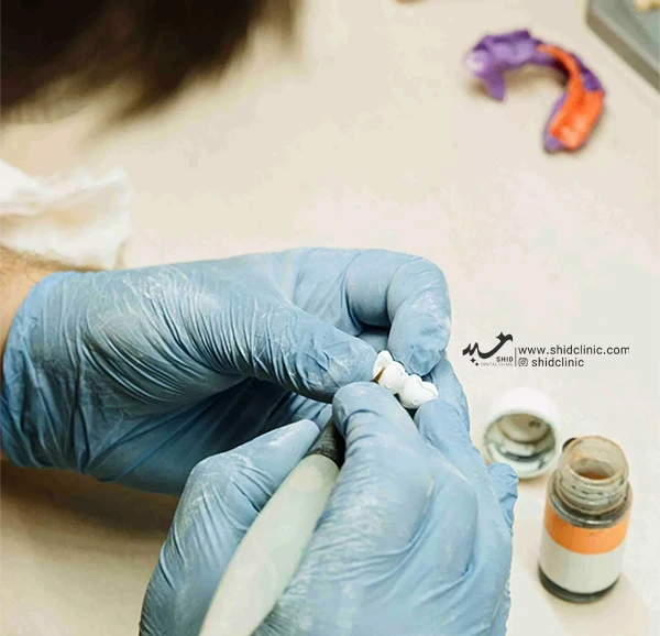 کلینیک دندانپزشکی شید دندان مصنوعی