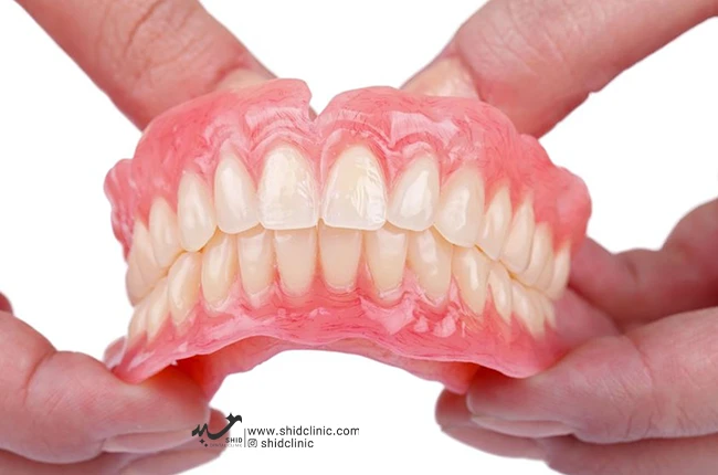 مراقبت‌های پس از جایگذاری دندان مصنوعی