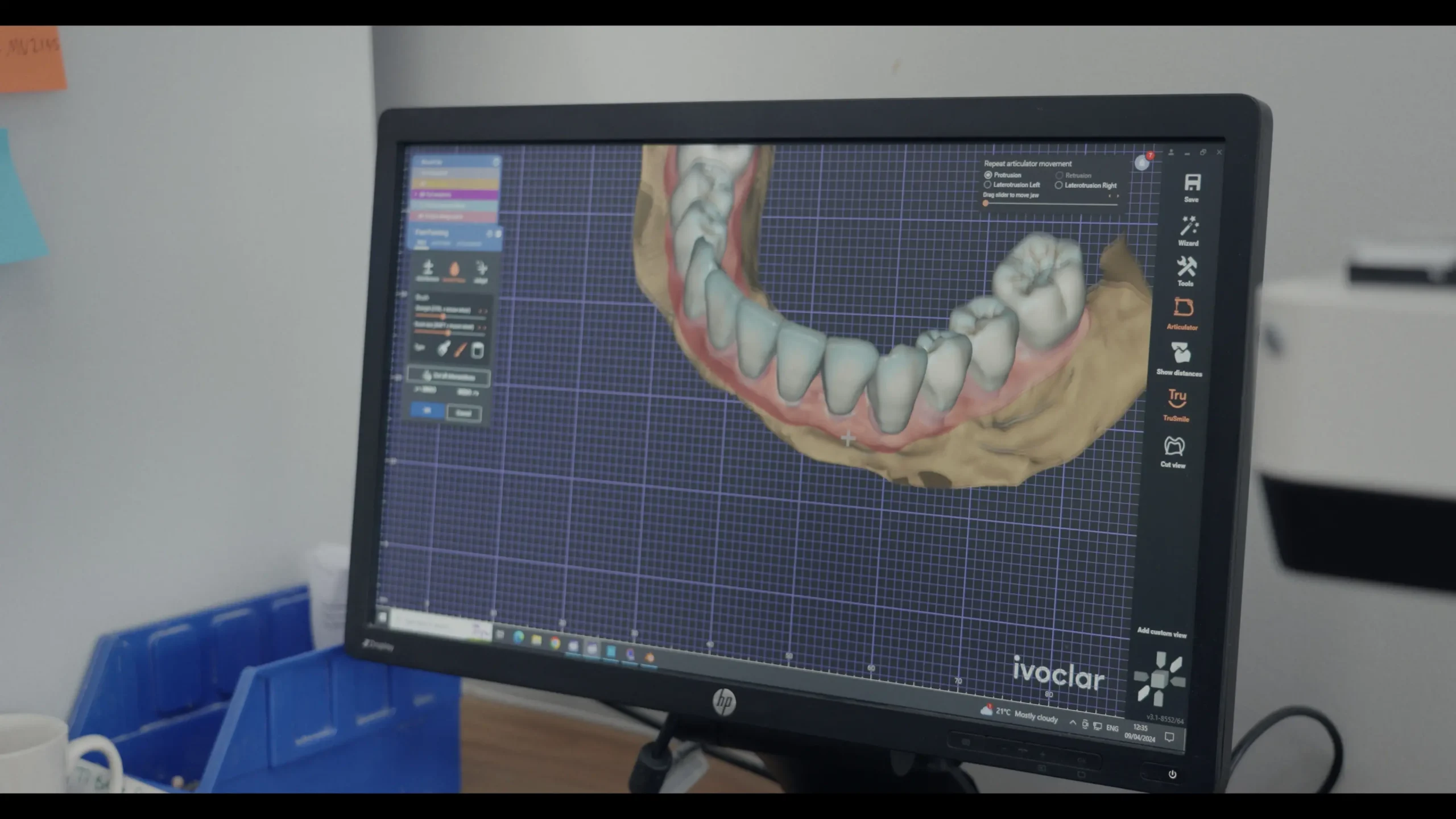بهترین لابراتوار دندانسازی در ازگل تهران