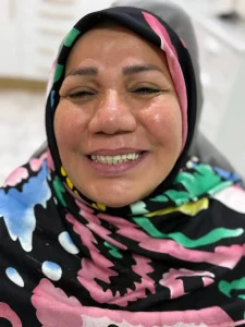 دندان مصنوعی کامل فک بالا پارسیل ژله ای یا فلکسی