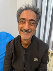 دندان مصنوعی بالا تکی (پارسیل) ژله ای