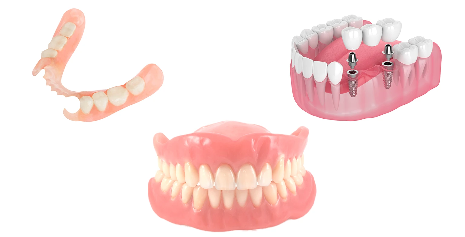 هزینه دندان مصنوعی کامل و تکه ای