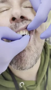 دندان مصنوعی