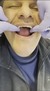 دندان مصنوعی