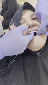 دندان مصنوعی