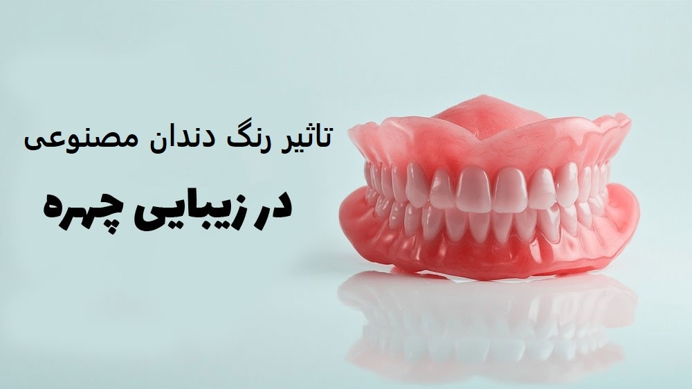 بهترین رنگ دندان مصنوعی (پروتز دندان سفید)