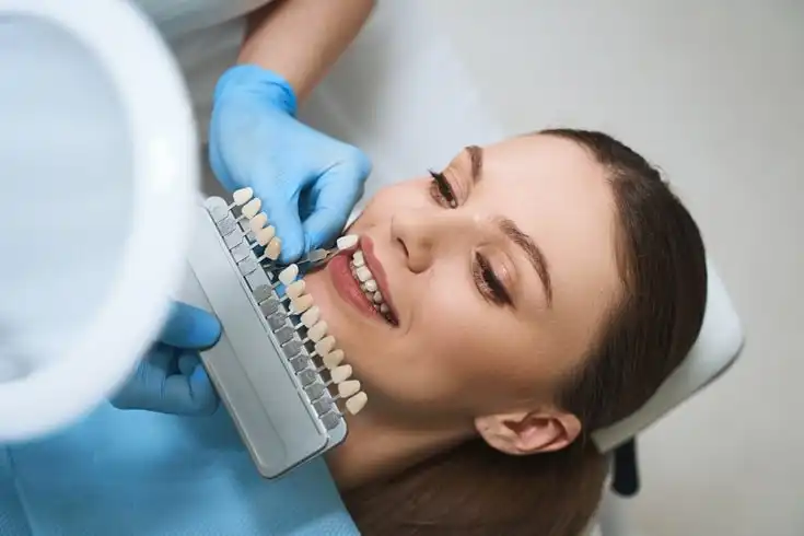 لمینت دندان بهتر است یا کامپوزیت؟