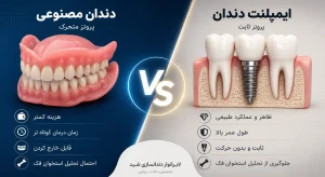 تفاوت دندان مصنوعی و ایمپلنت
